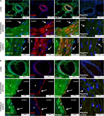 Chemerin Added to Endothelin-1 Promotes Rat Pulmonary Artery Smooth Muscle Cell Proliferation and Migration